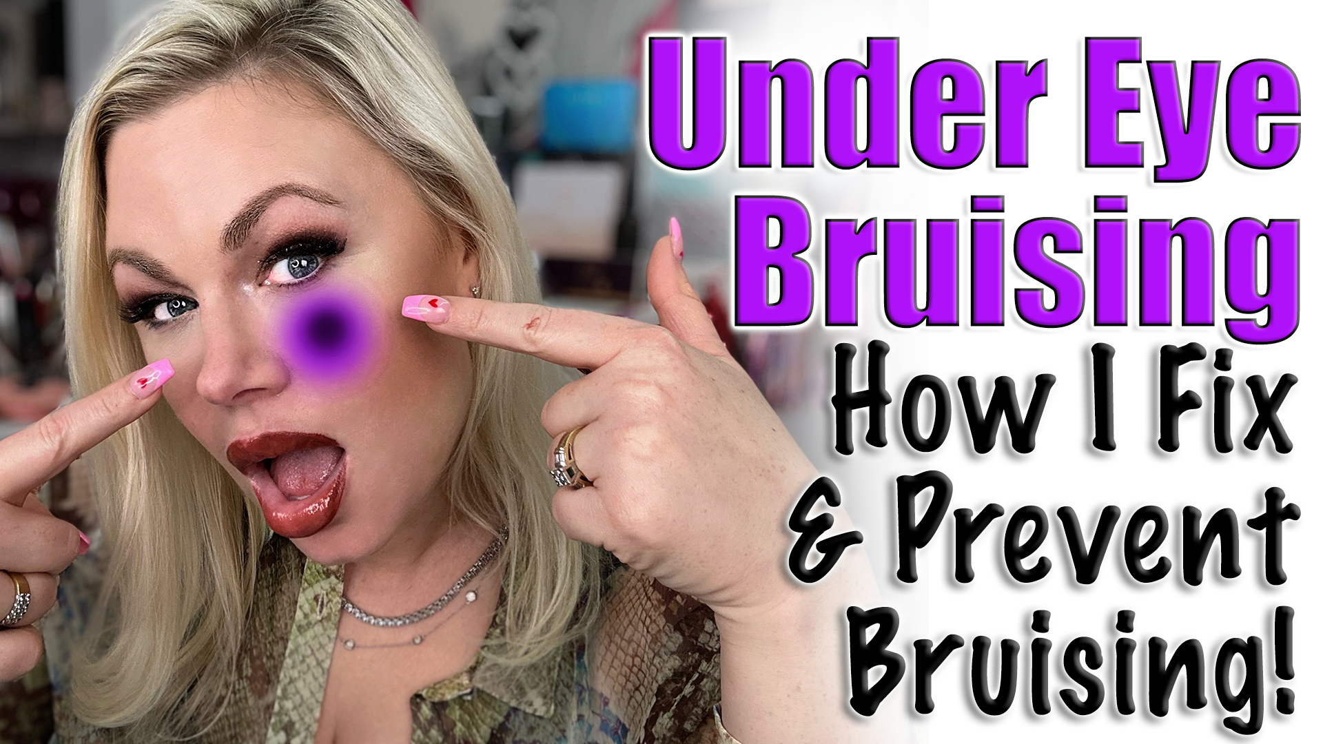 How to get rid of a bruise Bruise Correction